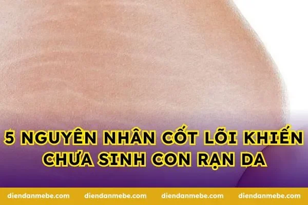5 nguyên nhân cốt lõi khiến chưa sinh con rạn da