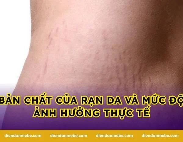 Bản chất của rạn da và mức độ ảnh hưởng thực tế
