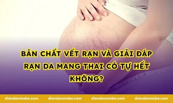 Bản chất vết rạn và giải đáp rạn da mang thai có tự hết không?
