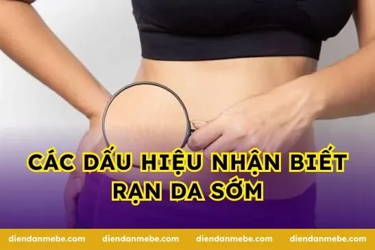 Các dấu hiệu nhận biết rạn da sớm