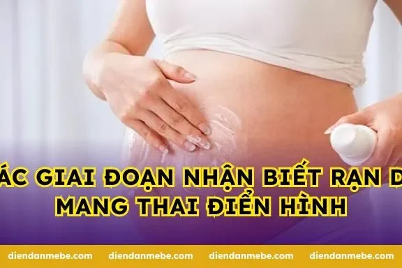Các giai đoạn nhận biết rạn da mang thai điển hình