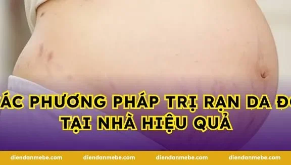 Các Phương Pháp Trị Rạn Da Đỏ Tại Nhà Hiệu Quả
