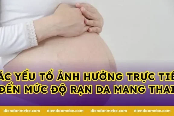 Các yếu tố ảnh hưởng trực tiếp đến mức độ rạn da mang thai
