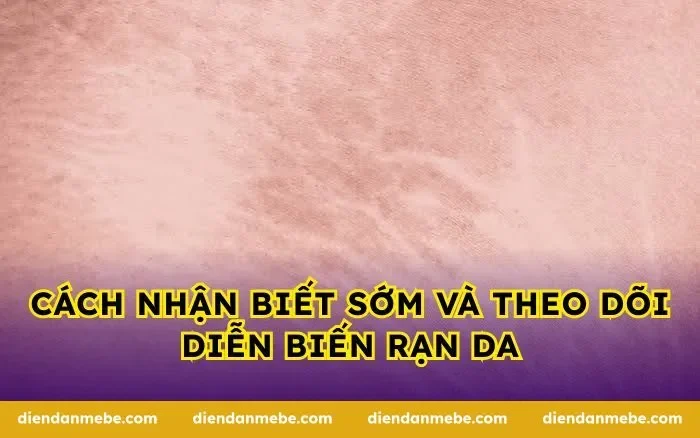 Cách nhận biết sớm và theo dõi diễn biến rạn da