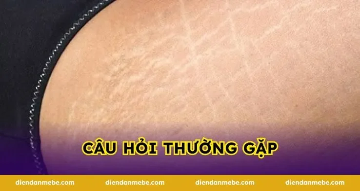 Câu hỏi thường gặp