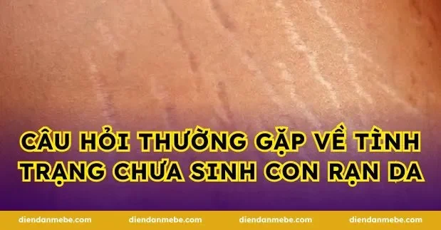 Câu hỏi thường gặp về tình trạng chưa sinh con rạn da