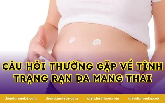 Câu hỏi thường gặp về tình trạng rạn da mang thai