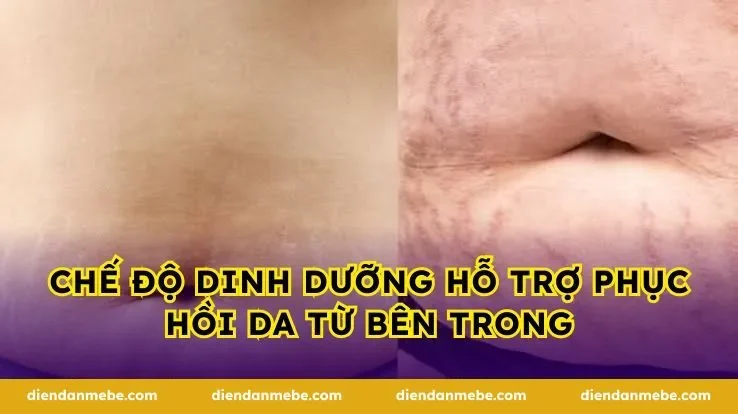 Chế Độ Dinh Dưỡng Hỗ Trợ Phục Hồi Da Từ Bên Trong