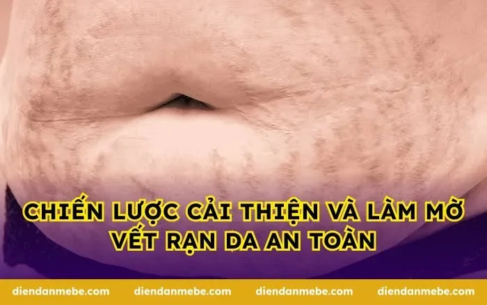 Chiến lược cải thiện và làm mờ vết rạn da an toàn