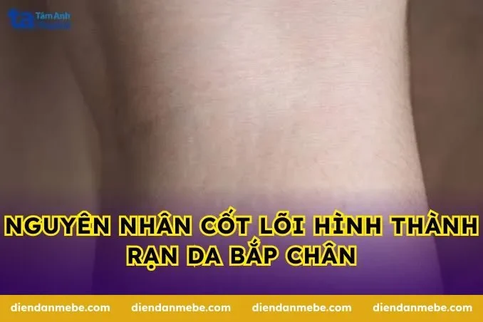 Nguyên nhân cốt lõi hình thành rạn da bắp chân