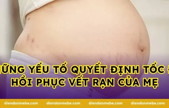 Những yếu tố quyết định tốc độ hồi phục vết rạn của mẹ