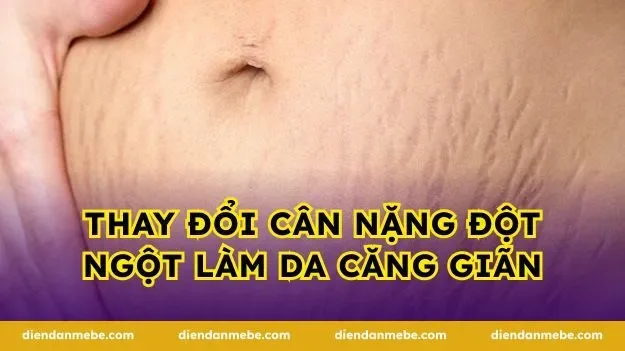 Thay đổi cân nặng đột ngột làm da căng giãn