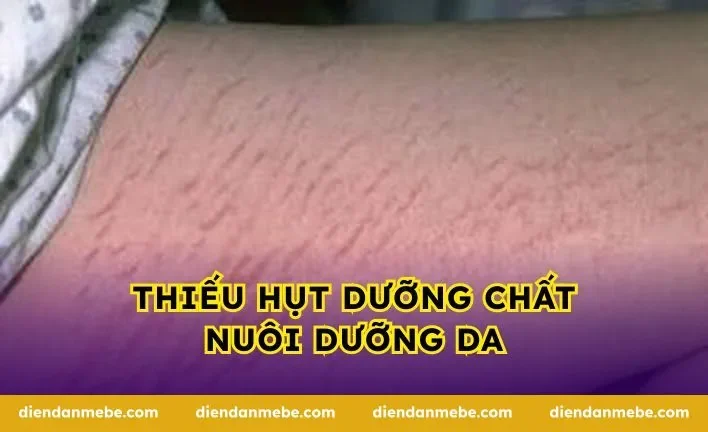 Thiếu hụt dưỡng chất nuôi dưỡng da